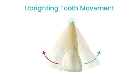Orthodontic Tooth Movement: Ultimate Guide For Doctors (2023).